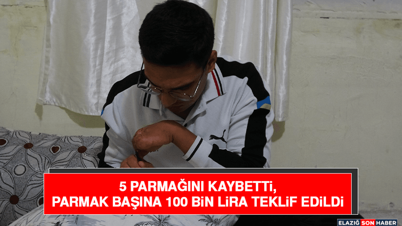 5 Parmağını Kaybetti, Parmak Başına 100 Bin Lira Teklif Edildi